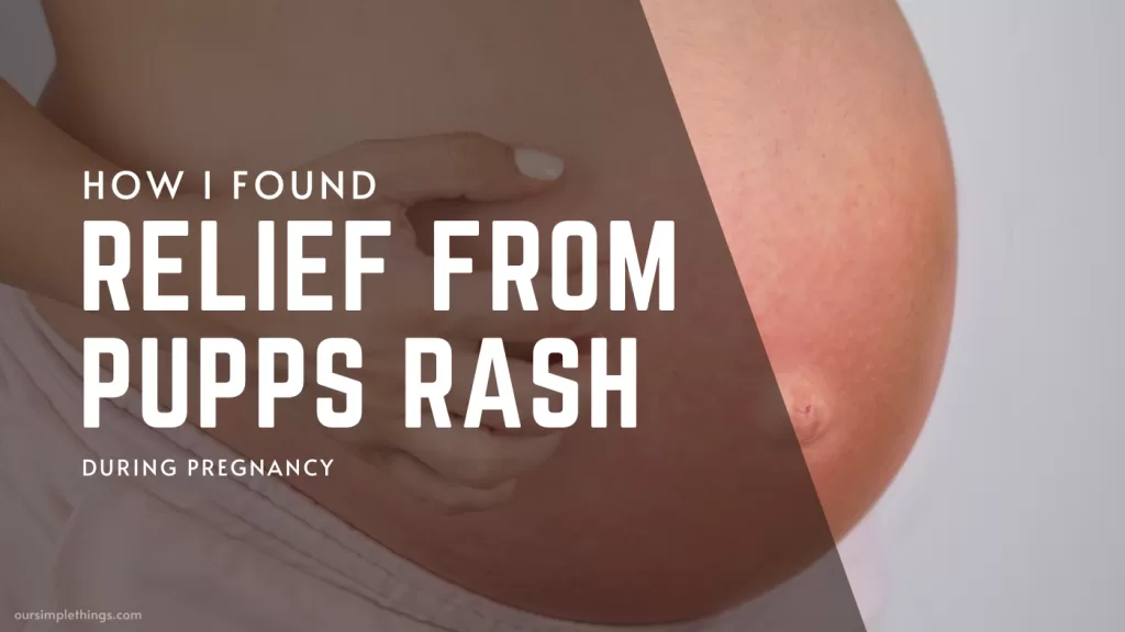How I Found Relief From PUPPs Rash During Pregnancy