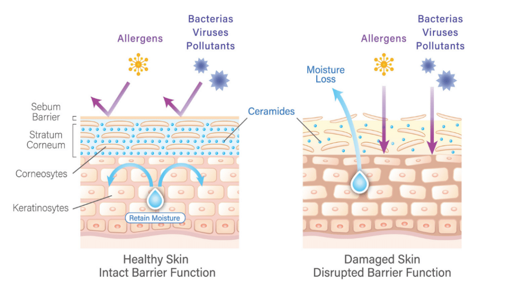 skin barrier function, diagram of healthy and damaged skin barrier